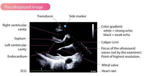 2d echo meaning tagalog|ECG vs. 2.